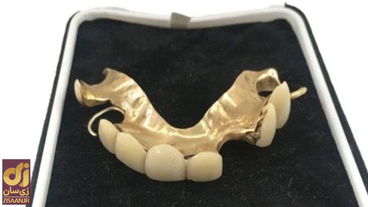 دندان چرچیل ۱۸۰۰۰ پوند فروش رفت