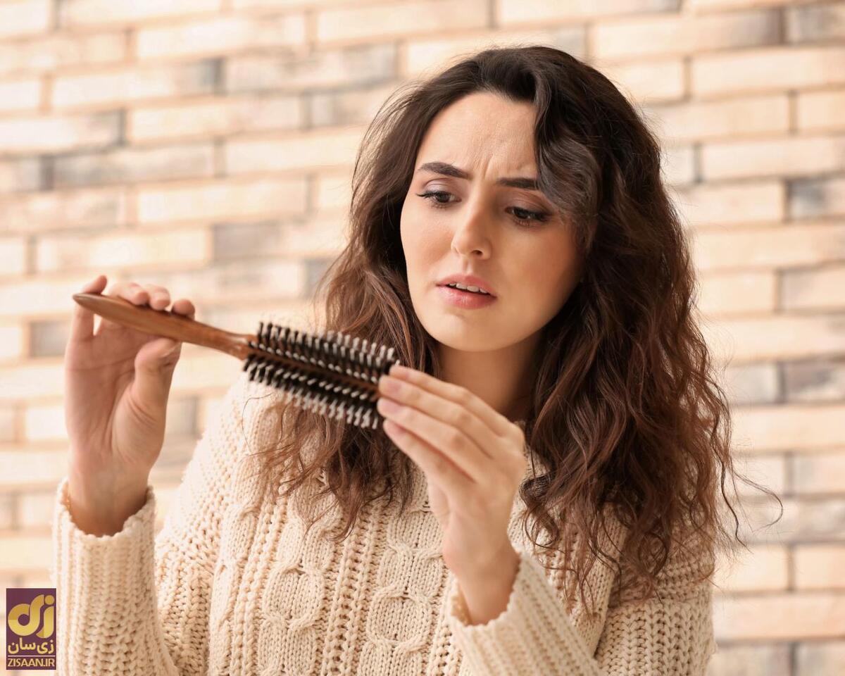 همه چیز درباره مایکرونیدلینگ برای درمان ریزش مو؛ چند بار مایکرونیدلینگ برای درمان ریزش مو؟