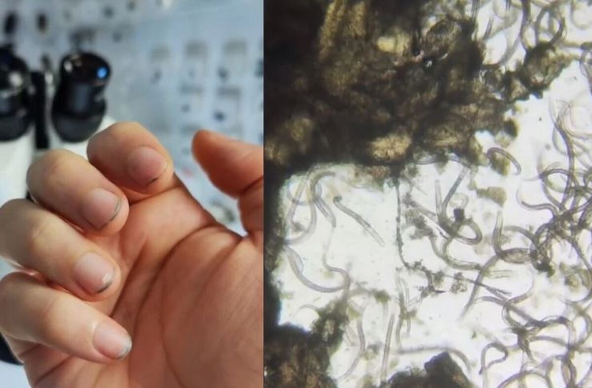 (ویدئو) زیرِ ناخن‌های کثیف در دنیای میکروسکوپی چه خبره؟