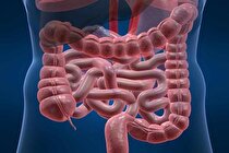 ۵ راهکار برای حفظ سلامتی روده